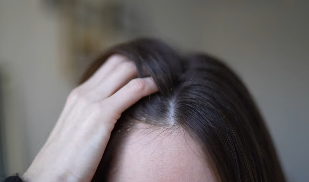 soin cheveux gras femme